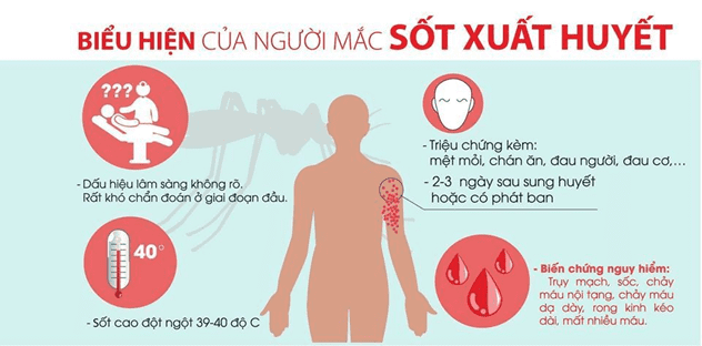 Các biểu hiện của người bị sốt xuất huyết